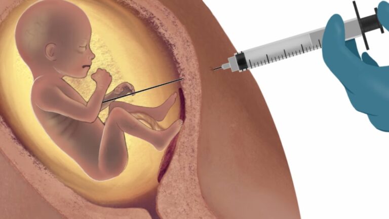 Relação entre a descriminalização do aborto e doenças sexualmente transmissíveis